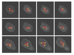 Cas5 Couples Stress Responses, Drug Resistance and Cell Cycle Regulation in Fungal Pathogens 